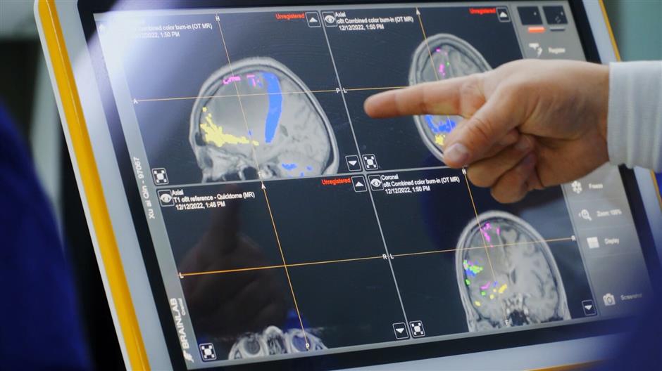 В Китае с помощью ИИ провели операцию на головном мозге через очень маленькое отверстие