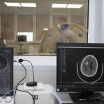 В Москве нейросеть теперь помогает находить ишемический инсульт на КТ головного мозга
