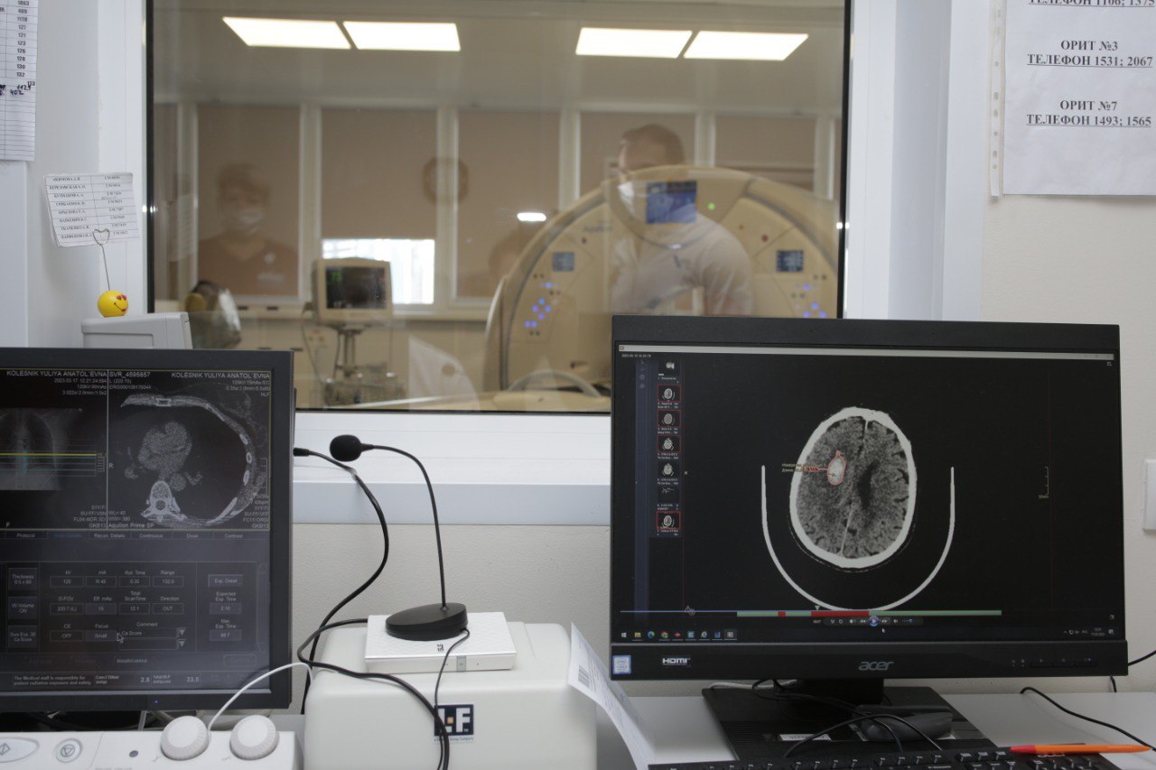 В Москве нейросеть теперь помогает находить ишемический инсульт на КТ головного мозга