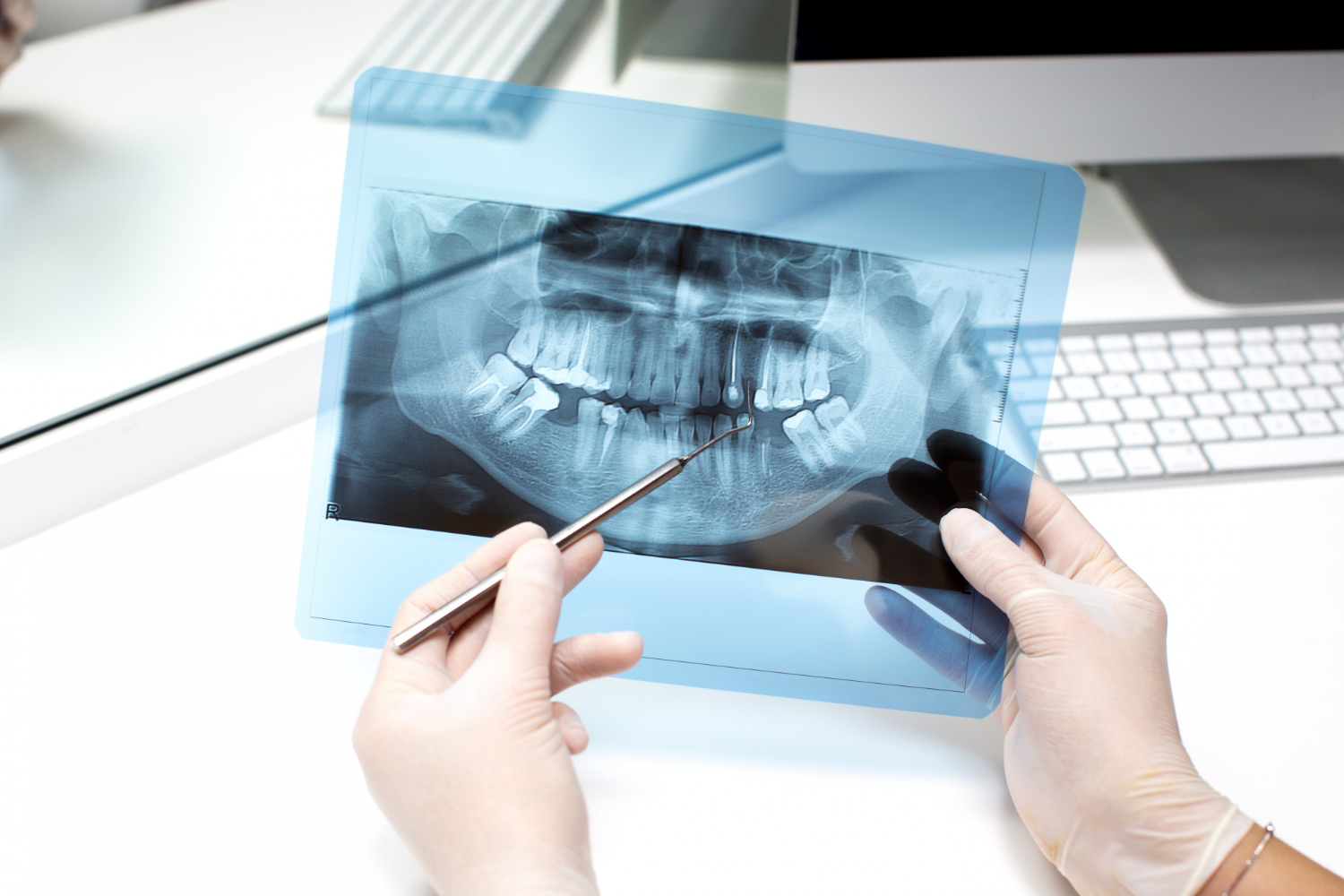 ИИ-алгоритм определяет пол человека по рентгеновским снимкам зубов