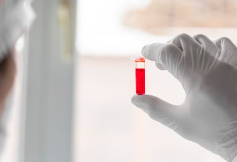 Нейросеть обучили определять содержание лейкоцитов в крови с точностью 90%